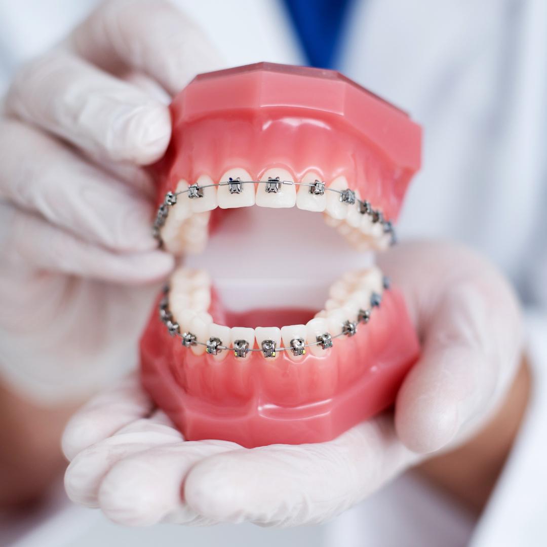 ortodoncia dentista